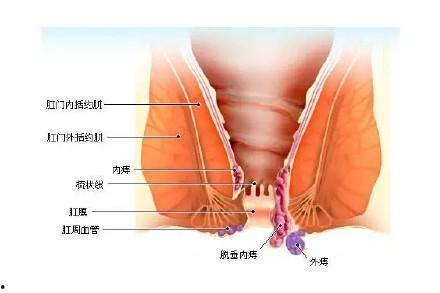 吃小乳瓜对痔疮好吗视频